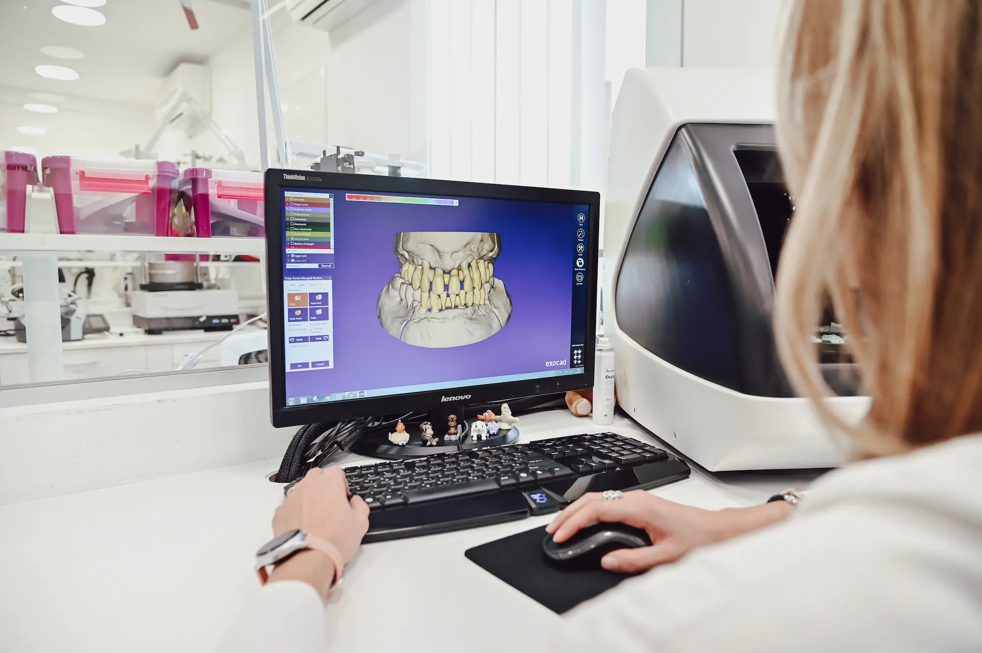 La tecnologia CAD/CAM 