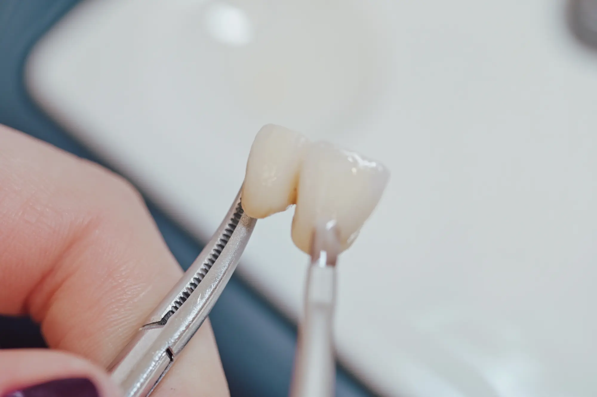 Laboratorio odontotecnico digitale