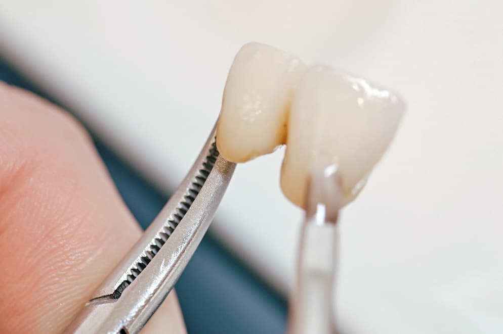 Materiali di alta qualità